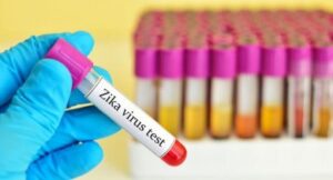 Zika Virus In Pune: Blood samples of 20 people sent for testing 