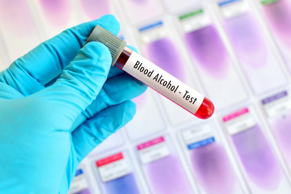 Pune: L3 pub case, blood samples of 14 people sent for medical examination