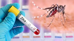 Pune: Third patient of Zika virus found in Hadapsar
