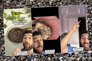 Man's Food Pipe Obstructed After Consuming Dry Chia Seeds with Water: Doctor Explains the Cause